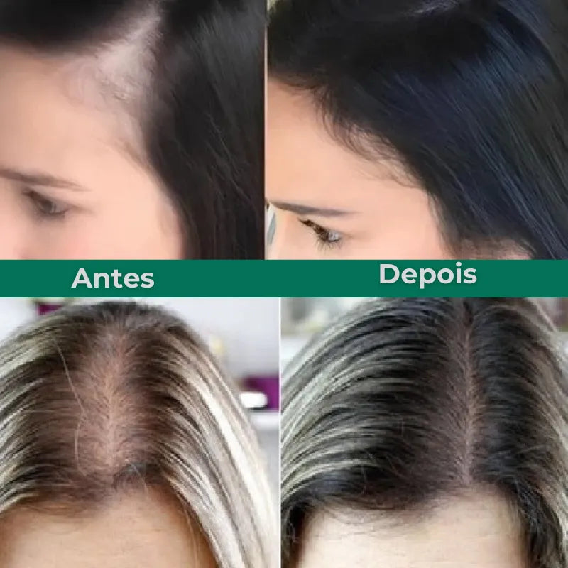 Queda de Cabelo Jole Store